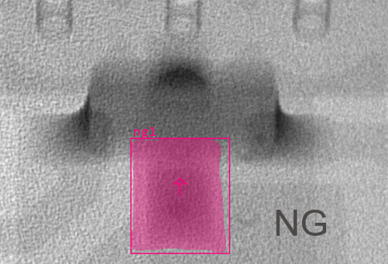 BGA Soldering Defect Detection - NG BGA soldering defect detection - NG