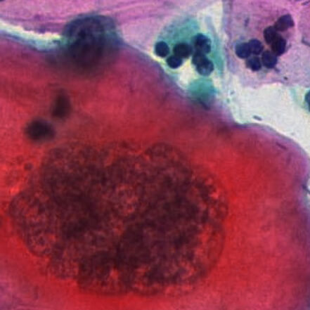 AI Visual Identification and Classification of Cells 4 重新繪製 癌症中期細胞