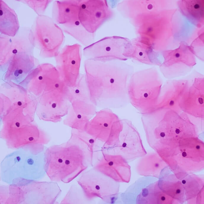 細胞病變辨識及分類解決方案 3 visual identification and classification of cells